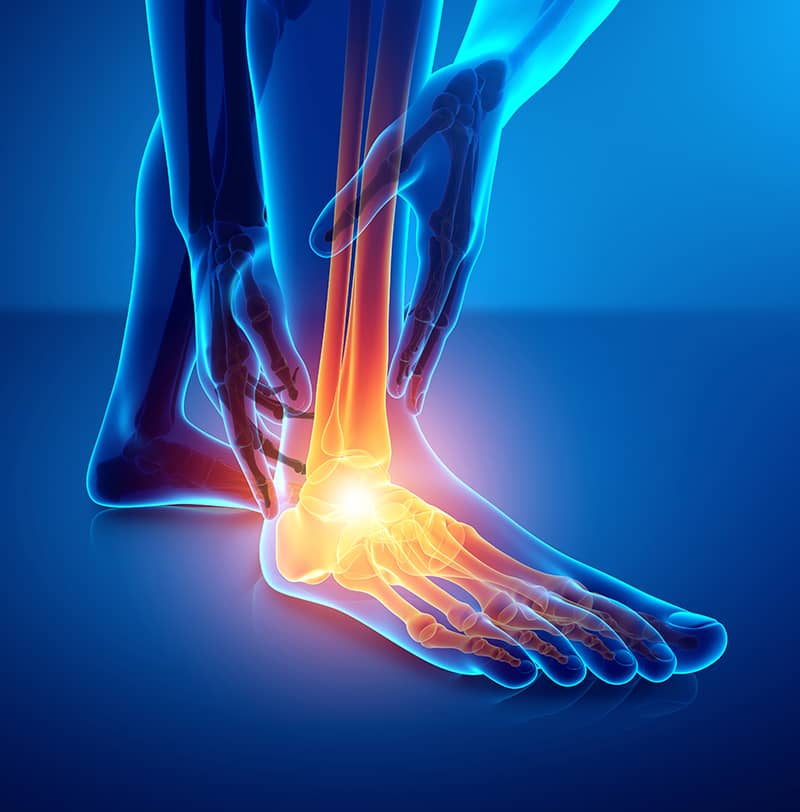 Ankle Pain Exectech